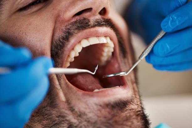 Best Chipped Tooth Repair Near Me  in Inverness, IL