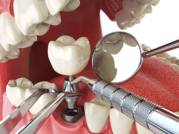 Best Knocked-Out Tooth Emergency  in Inverness, IL